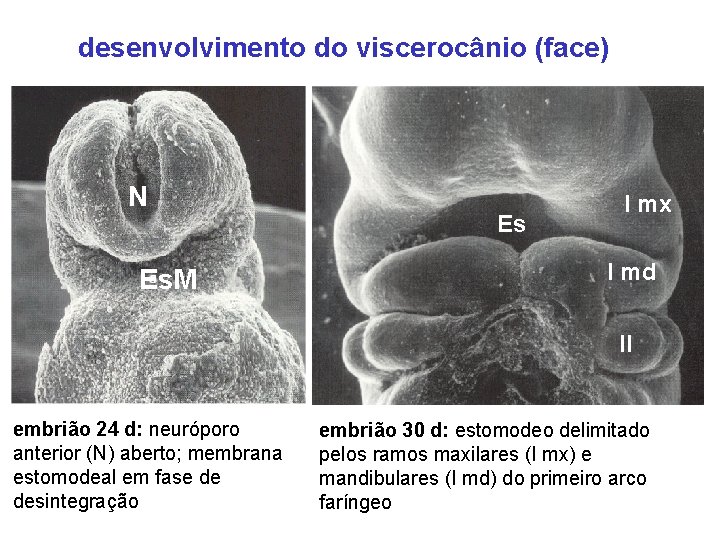desenvolvimento do viscerocânio (face) N Es. M Es I mx I md II embrião