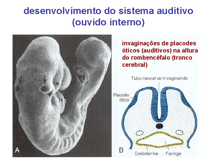 desenvolvimento do sistema auditivo (ouvido interno) invaginações de placodes óticos (auditivos) na altura do
