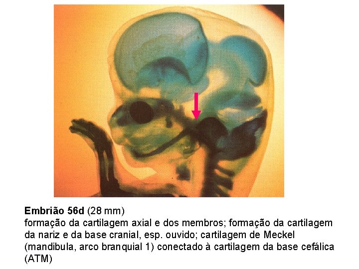 E N M Embrião 56 d (28 mm) formação da cartilagem axial e dos