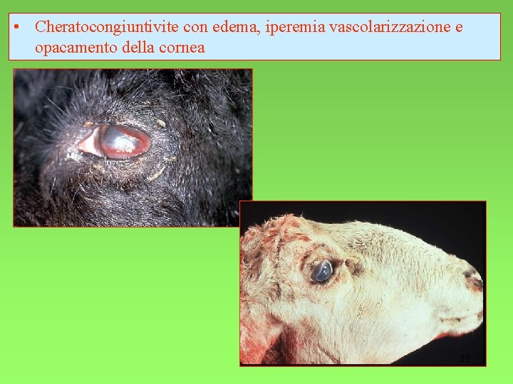  • Cheratocongiuntivite con edema, iperemia vascolarizzazione e opacamento della cornea 23 