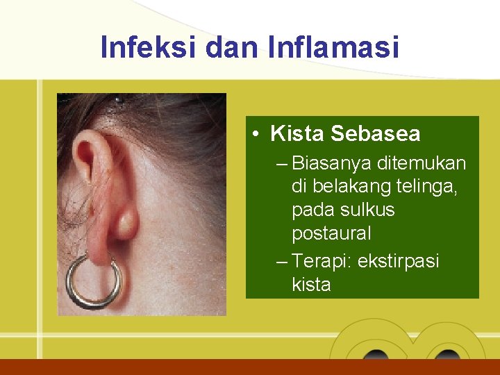 Infeksi dan Inflamasi • Kista Sebasea – Biasanya ditemukan di belakang telinga, pada sulkus