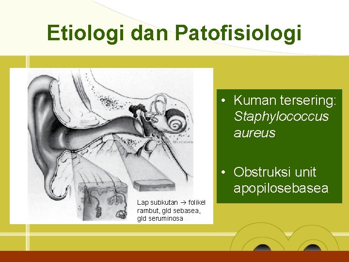 Etiologi dan Patofisiologi • Kuman tersering: Staphylococcus aureus • Obstruksi unit apopilosebasea Lap subkutan