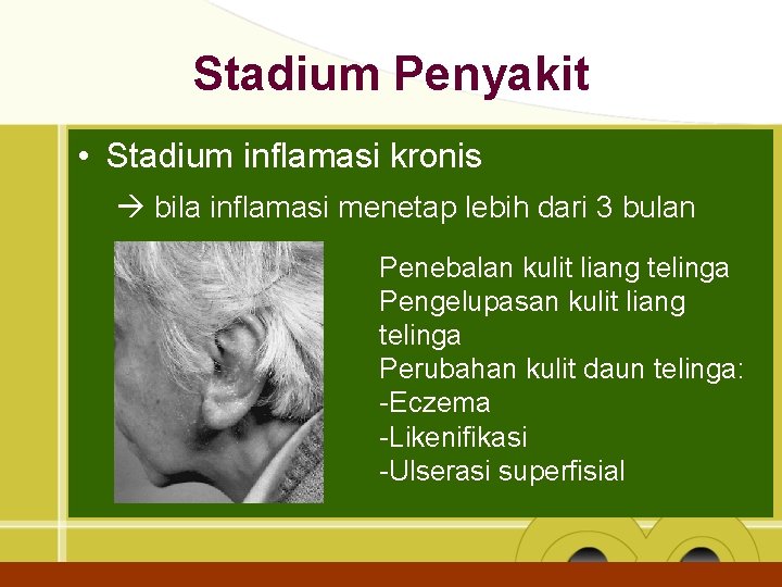 Stadium Penyakit • Stadium inflamasi kronis bila inflamasi menetap lebih dari 3 bulan Penebalan