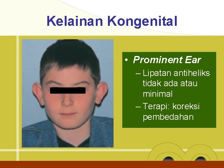Kelainan Kongenital • Prominent Ear – Lipatan antiheliks tidak ada atau minimal – Terapi: