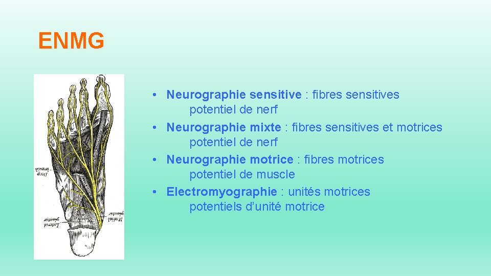 ENMG • Neurographie sensitive : fibres sensitives potentiel de nerf • Neurographie mixte :