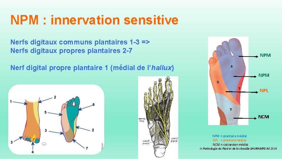 NPM : innervation sensitive Nerfs digitaux communs plantaires 1 -3 => Nerfs digitaux propres