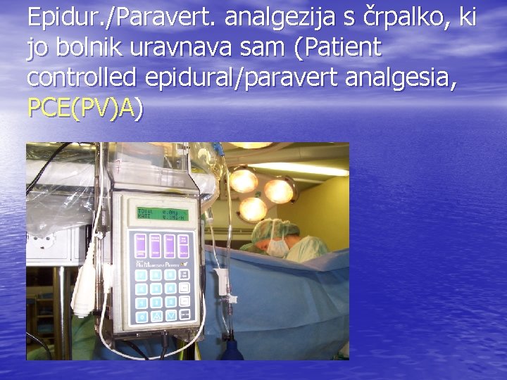 Epidur. /Paravert. analgezija s črpalko, ki jo bolnik uravnava sam (Patient controlled epidural/paravert analgesia,
