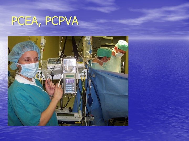 PCEA, PCPVA 