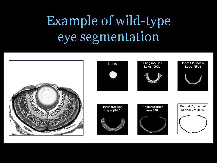 Example of wild-type eye segmentation Lens Ganglion Cell Layer (GCL) Inner Plexiform Layer (IPL)