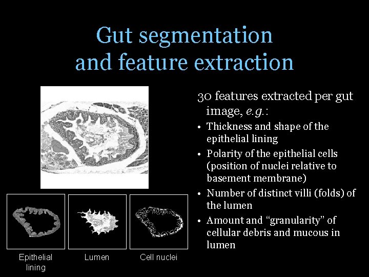 Gut segmentation and feature extraction 30 features extracted per gut image, e. g. :