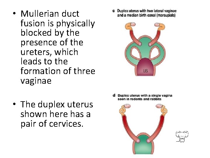  • Mullerian duct fusion is physically blocked by the presence of the ureters,