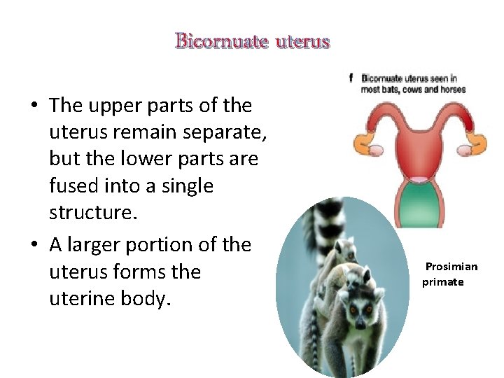 Bicornuate uterus • The upper parts of the uterus remain separate, but the lower
