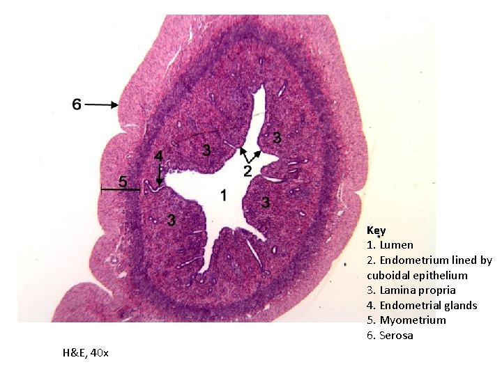 Key 1. Lumen 2. Endometrium lined by cuboidal epithelium 3. Lamina propria 4. Endometrial