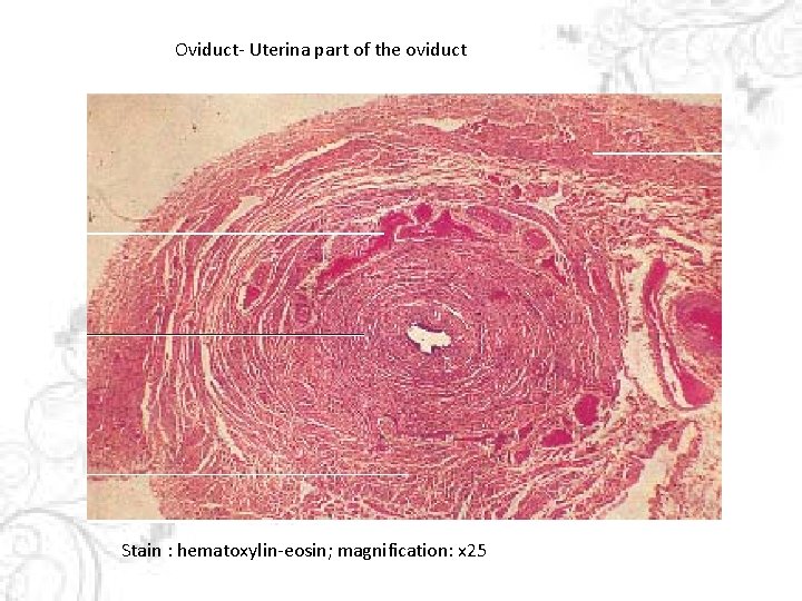 Oviduct- Uterina part of the oviduct Stain : hematoxylin-eosin; magnification: x 25 