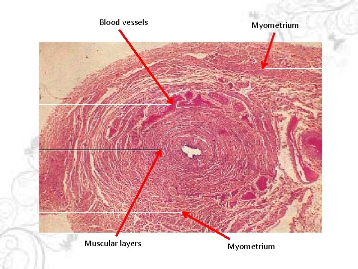 Blood vessels Muscular layers Myometrium 