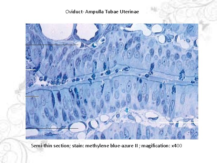 Oviduct- Ampulla Tubae Uterinae Semi-thin section; stain: methylene blue-azure II ; magification: x 400