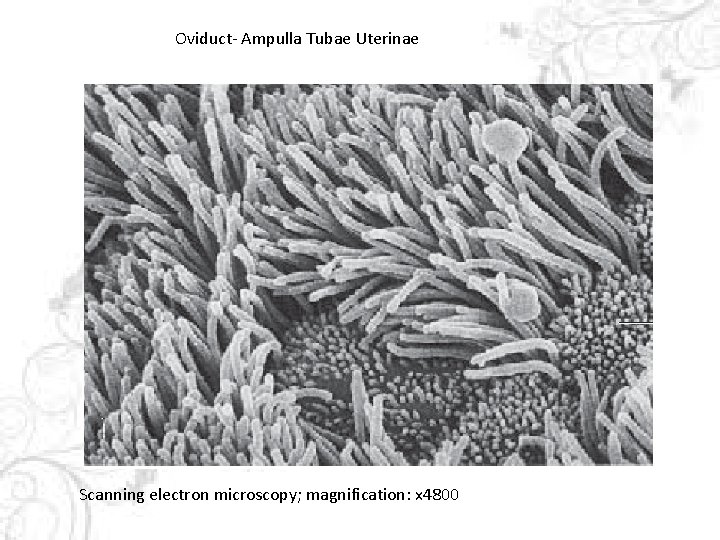 Oviduct- Ampulla Tubae Uterinae Scanning electron microscopy; magnification: x 4800 