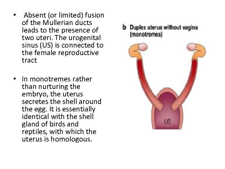  • Absent (or limited) fusion of the Mullerian ducts leads to the presence