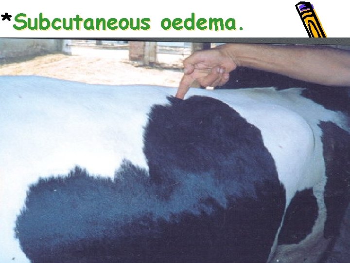 *Subcutaneous oedema. 