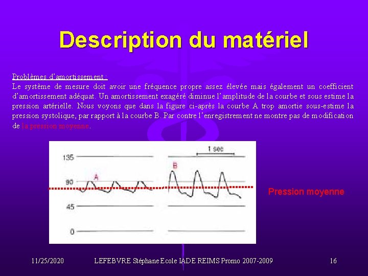 Description du matériel Problèmes d’amortissement : Le système de mesure doit avoir une fréquence