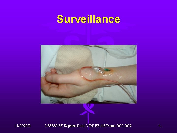 Surveillance 11/25/2020 LEFEBVRE Stéphane Ecole IADE REIMS Promo 2007 -2009 41 