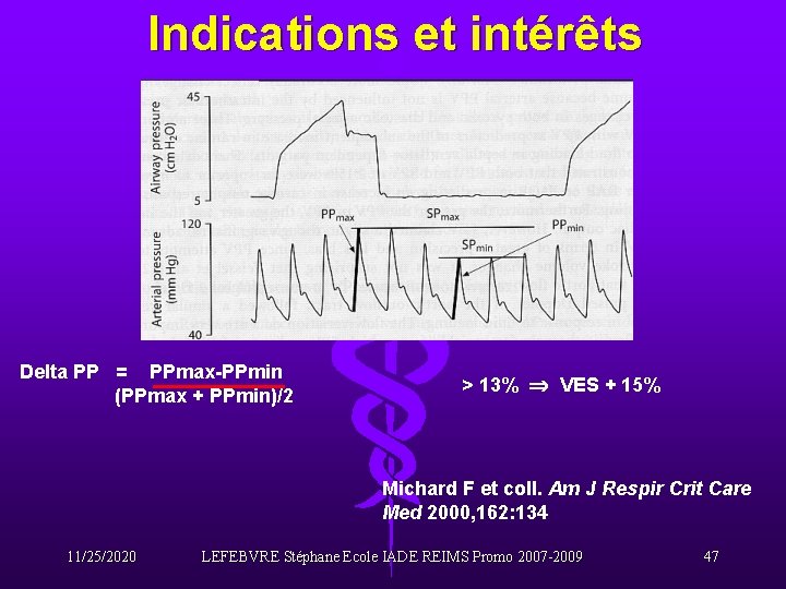 Indications et intérêts Delta PP = PPmax-PPmin (PPmax + PPmin)/2 > 13% VES +