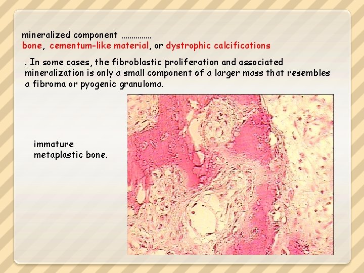 mineralized component …………… bone, cementum-like material, or dystrophic calcifications. In some cases, the fibroblastic