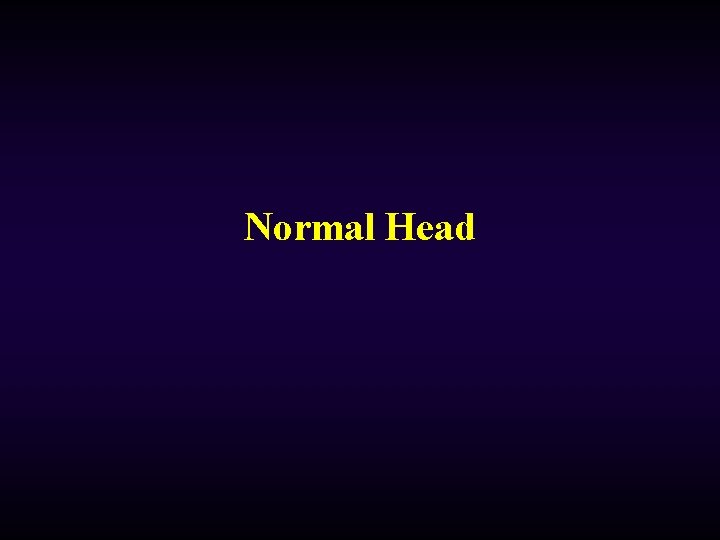 Normal Head 