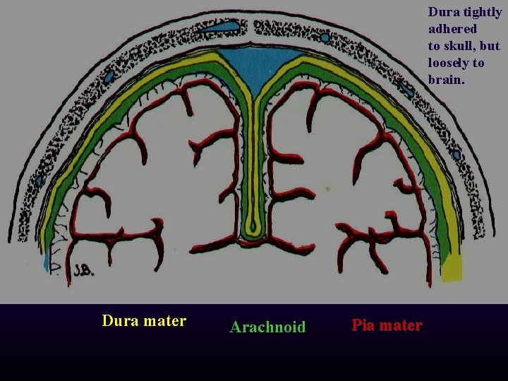 Dura tightly adhered to skull, but loosely to brain. Dura mater Arachnoid Pia mater