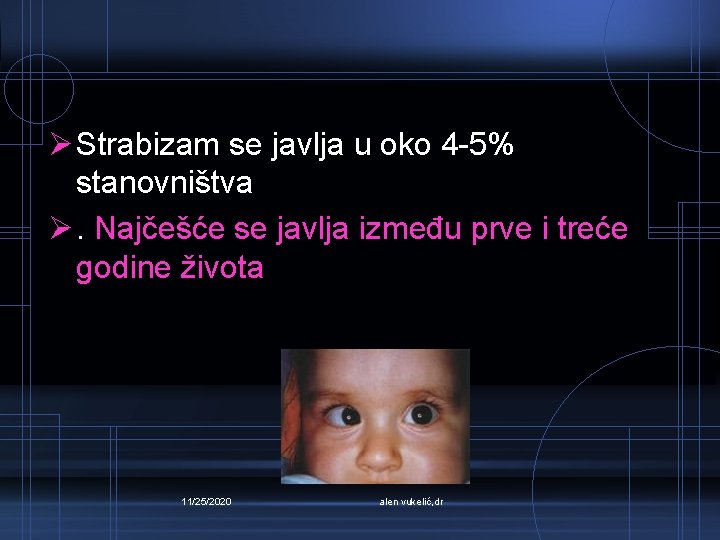 Ø Strabizam se javlja u oko 4 -5% stanovništva Ø. Najčešće se javlja između