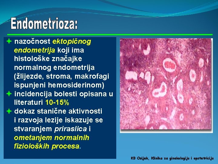  nazočnost ektopičnog endometrija koji ima histološke značajke normalnog endometrija (žlijezde, stroma, makrofagi ispunjeni