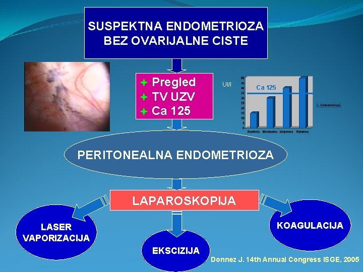 SUSPEKTNA ENDOMETRIOZA BEZ OVARIJALNE CISTE Pregled TV UZV Ca 125 UI/l Ca 125 PERITONEALNA