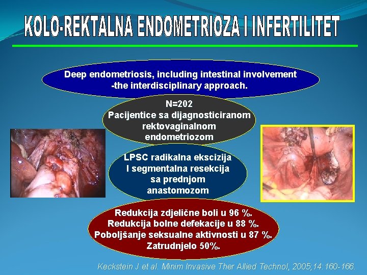 Deep endometriosis, including intestinal involvement -the interdisciplinary approach. N=202 Pacijentice sa dijagnosticiranom rektovaginalnom endometriozom