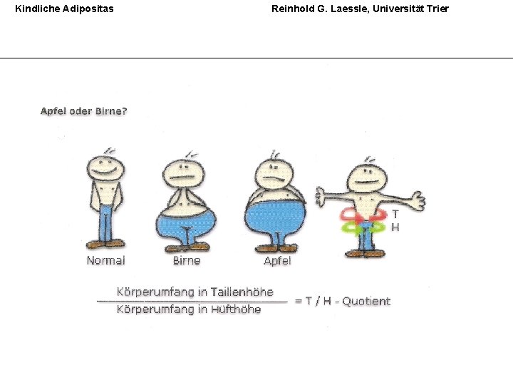 Kindliche Adipositas Reinhold G. Laessle, Universität Trier 