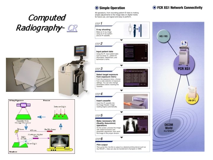 Computed Radiography- CR 