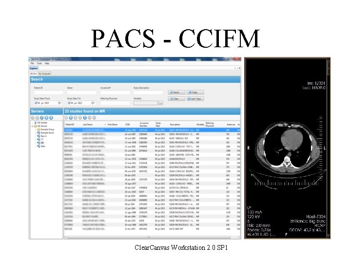 PACS - CCIFM Clear. Canvas Workstation 2. 0 SP 1 