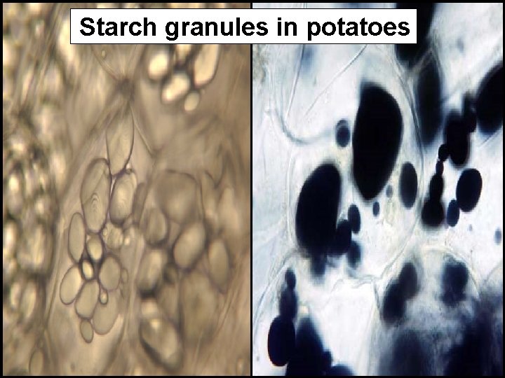Starch granules in potatoes 