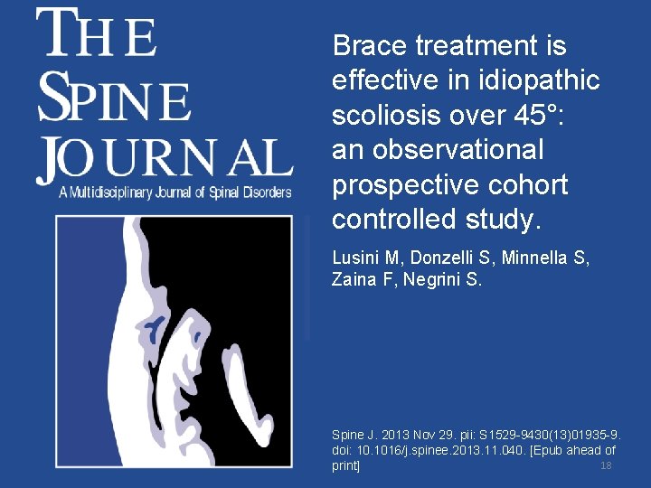 Brace treatment is effective in idiopathic scoliosis over 45°: an observational prospective cohort controlled