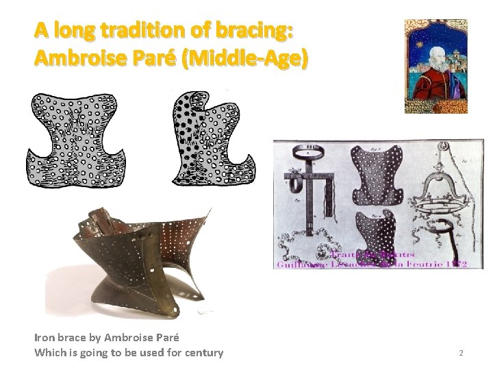 A long tradition of bracing: Ambroise Paré (Middle-Age) Iron brace by Ambroise Paré Which