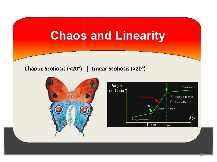 Chaos and Linearity Chaotic Scoliosis (<20°) | Linear Scoliosis (>20°) 24 