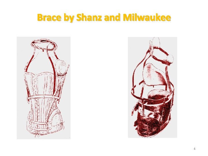 Brace by Shanz and Milwaukee 4 