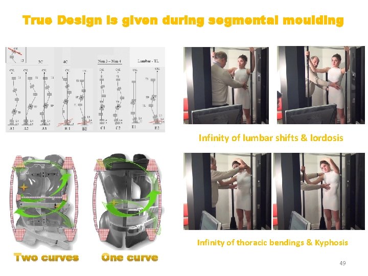 True Design is given during segmental moulding Infinity of lumbar shifts & lordosis Infinity