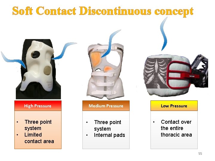 Soft Contact Discontinuous concept High Pressure • • Three point system Limited contact area