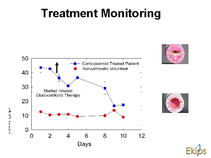 Treatment Monitoring 