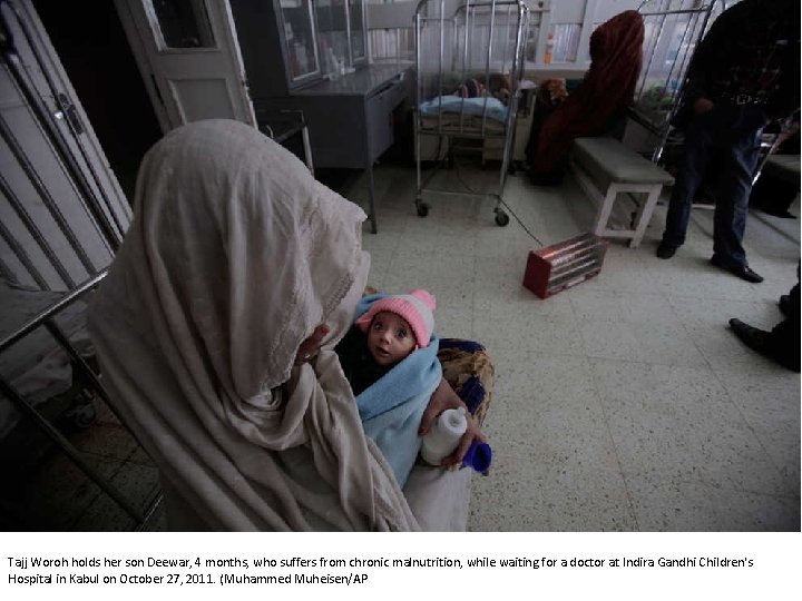 Tajj Woroh holds her son Deewar, 4 months, who suffers from chronic malnutrition, while