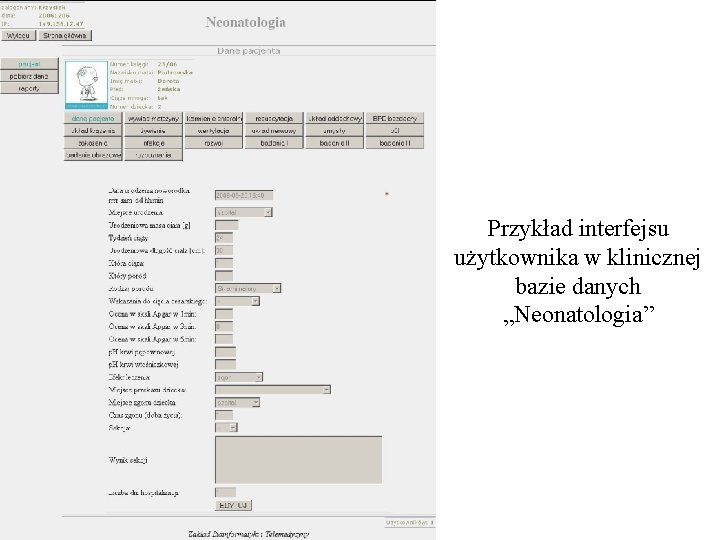 Przykład interfejsu użytkownika w klinicznej bazie danych „Neonatologia” 