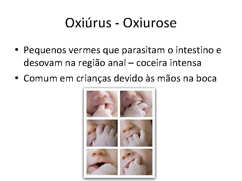 Oxiúrus - Oxiurose • Pequenos vermes que parasitam o intestino e desovam na região
