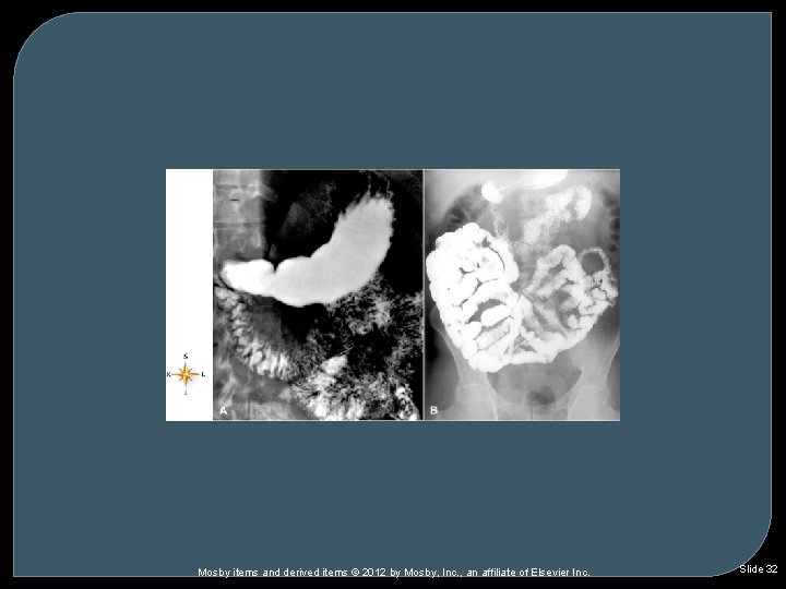 Mosby items and derived items © 2012 by Mosby, Inc. , an affiliate of Mosby items and derived items © 2012 by Mosby, Inc. , an affiliate of