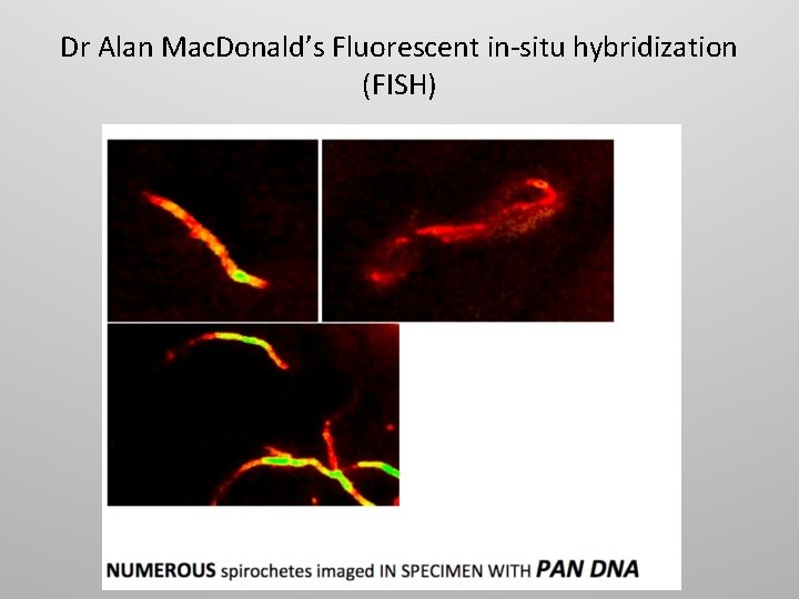 Dr Alan Mac. Donald’s Fluorescent in-situ hybridization (FISH) 