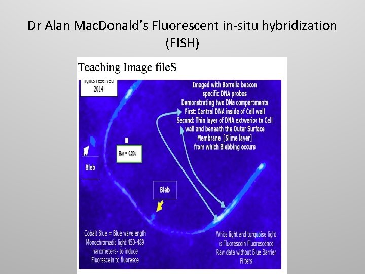 Dr Alan Mac. Donald’s Fluorescent in-situ hybridization (FISH) 